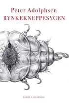 Rynkekneppesygen