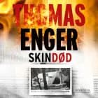 Skindød