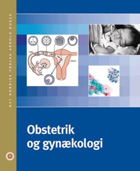 Obstetrik og gynækologi af Lene Lundvall