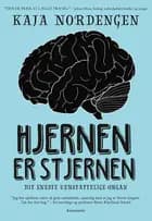 Hjernen er stjernen